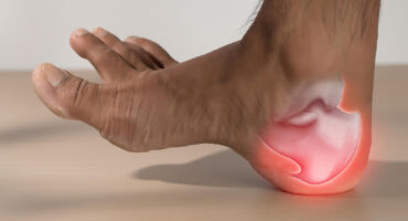 Plantar Fasciitis Mobile Foot Doctor Los Angeles